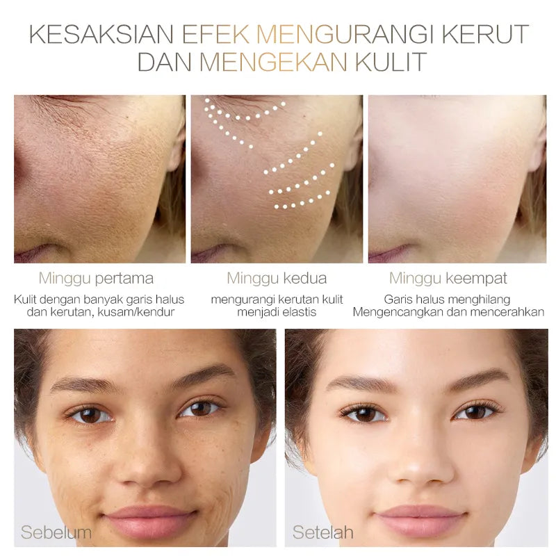 Chalonese Brightening Cream