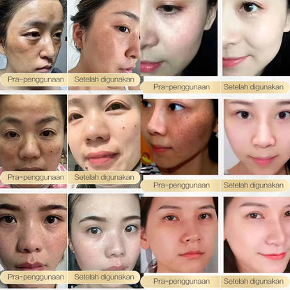 Chalonese Brightening Cream